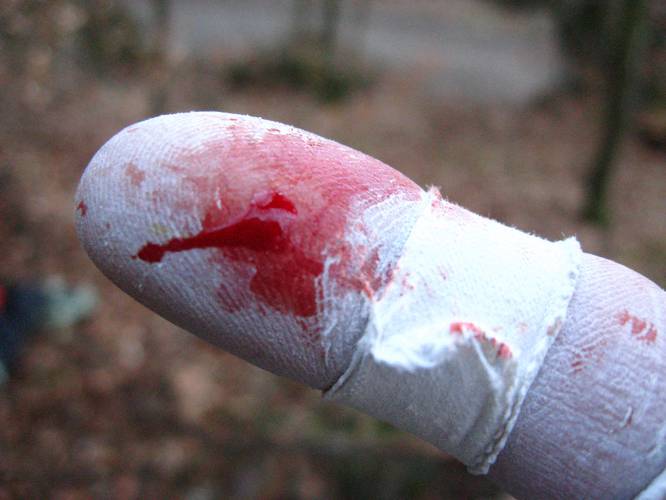 Bloody Sunday
